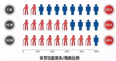 关节反复痛注意！京沪川三甲