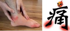 肥胖者易患上痛风是真的吗