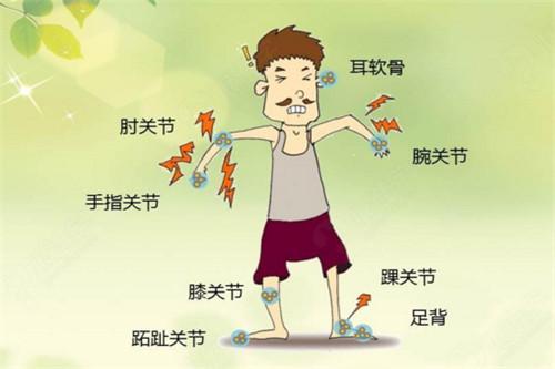成都治疗痛风