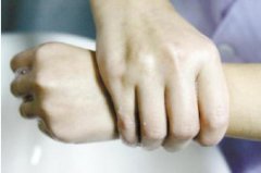 双手双脚都有痛风该怎么治?