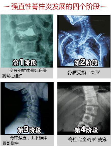 成都强直医院