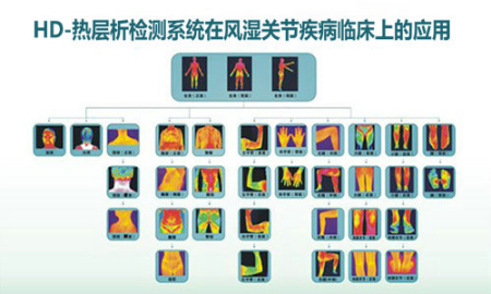 成都治疗类风湿的医院